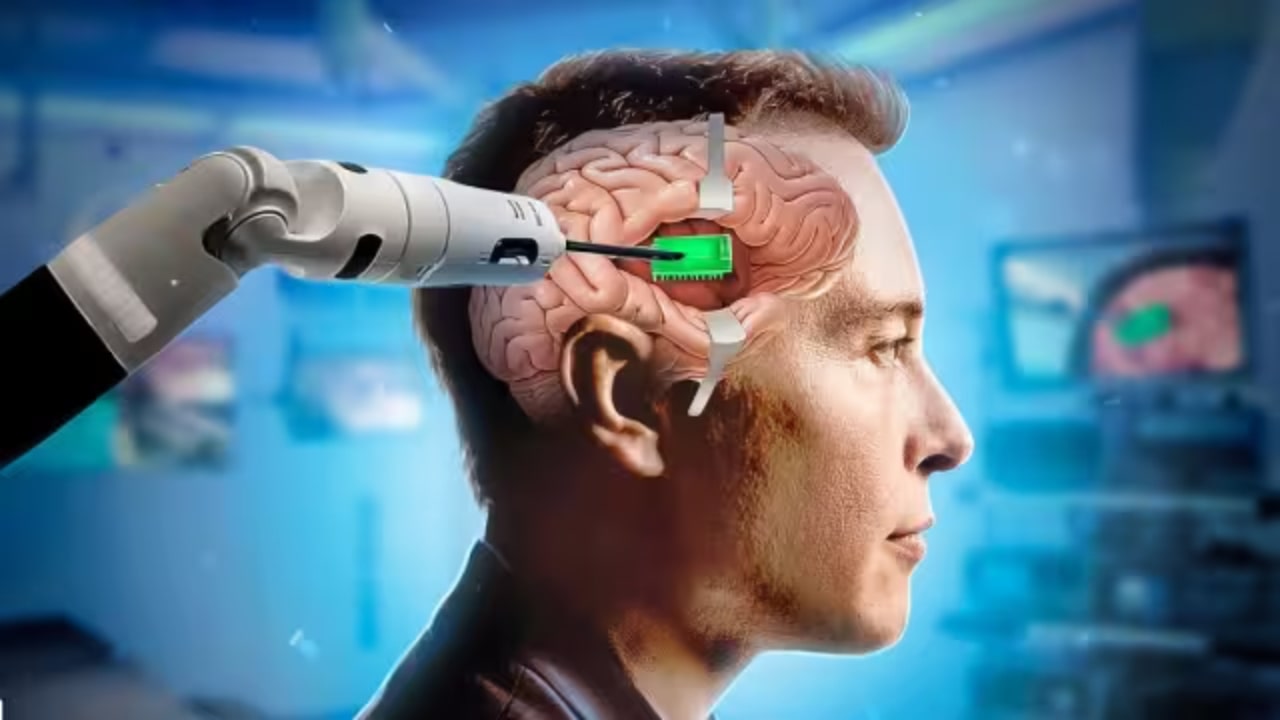 Neuralink Chip In Brain