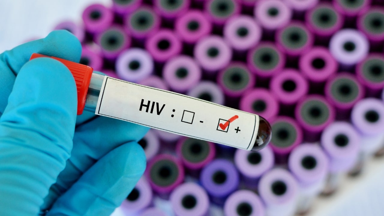 HIV